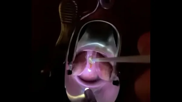 Cytology brush harika Tube'u izleyin